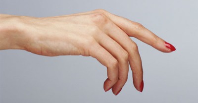 Лечение артрита пальцев